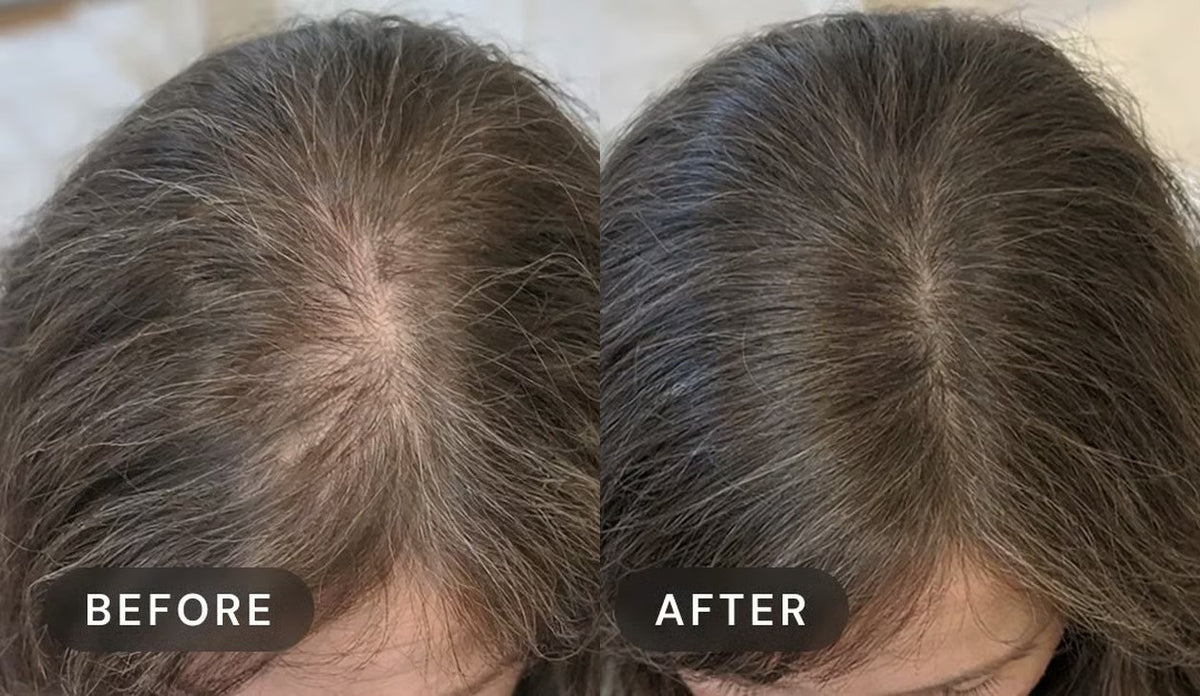 Manufacturer's user trial, before and after: a woman's centre part seen from above, looking fuller after