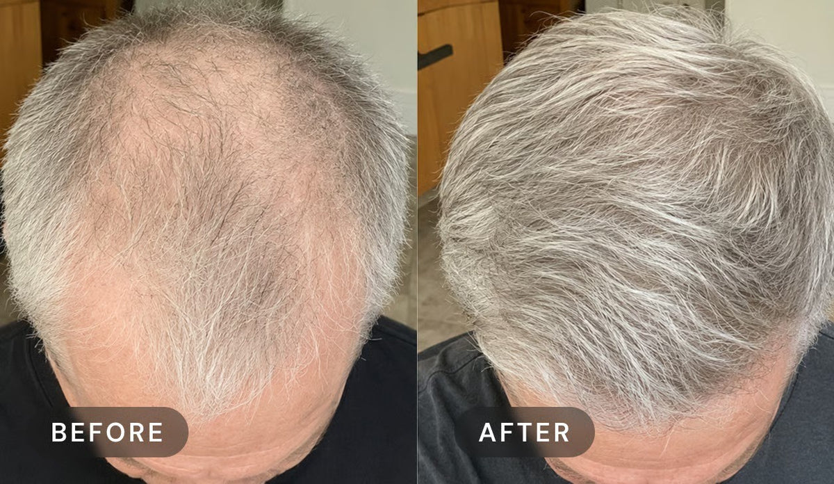 Manufacturer's user trial, before and after: top of a man's head with grey hair, seen from above