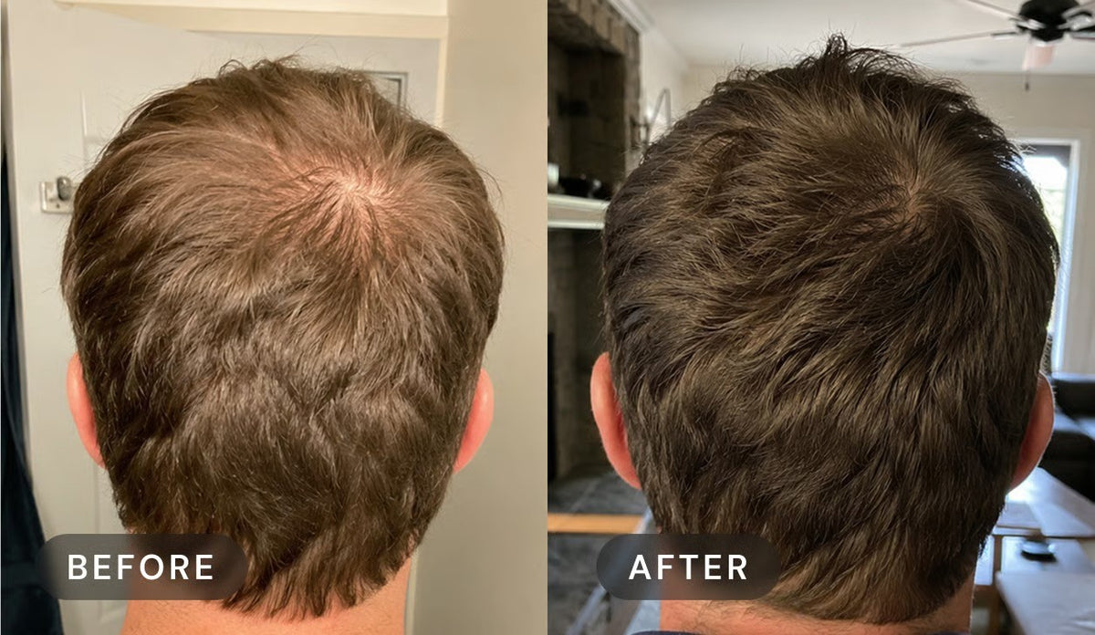 Manufacturer's user trial, before and after: a man's crown with brown hair, seen from behind