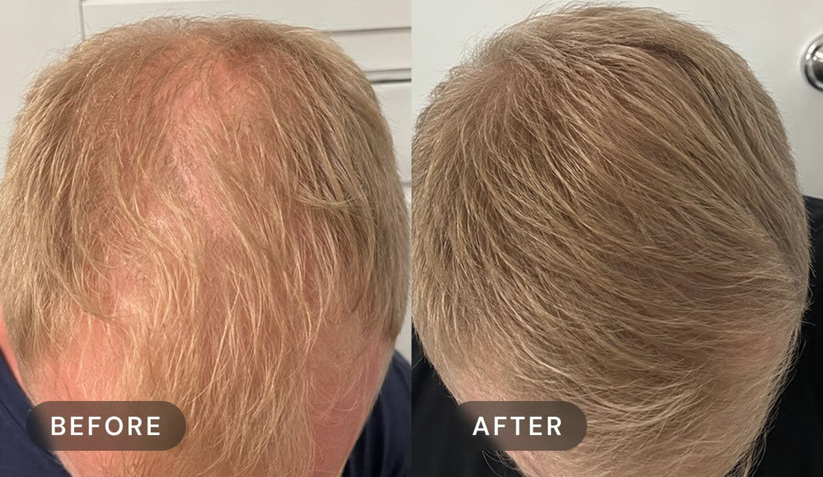 Manufacturer's user trial, before and after: top of a man's head with fair hair, seen from above