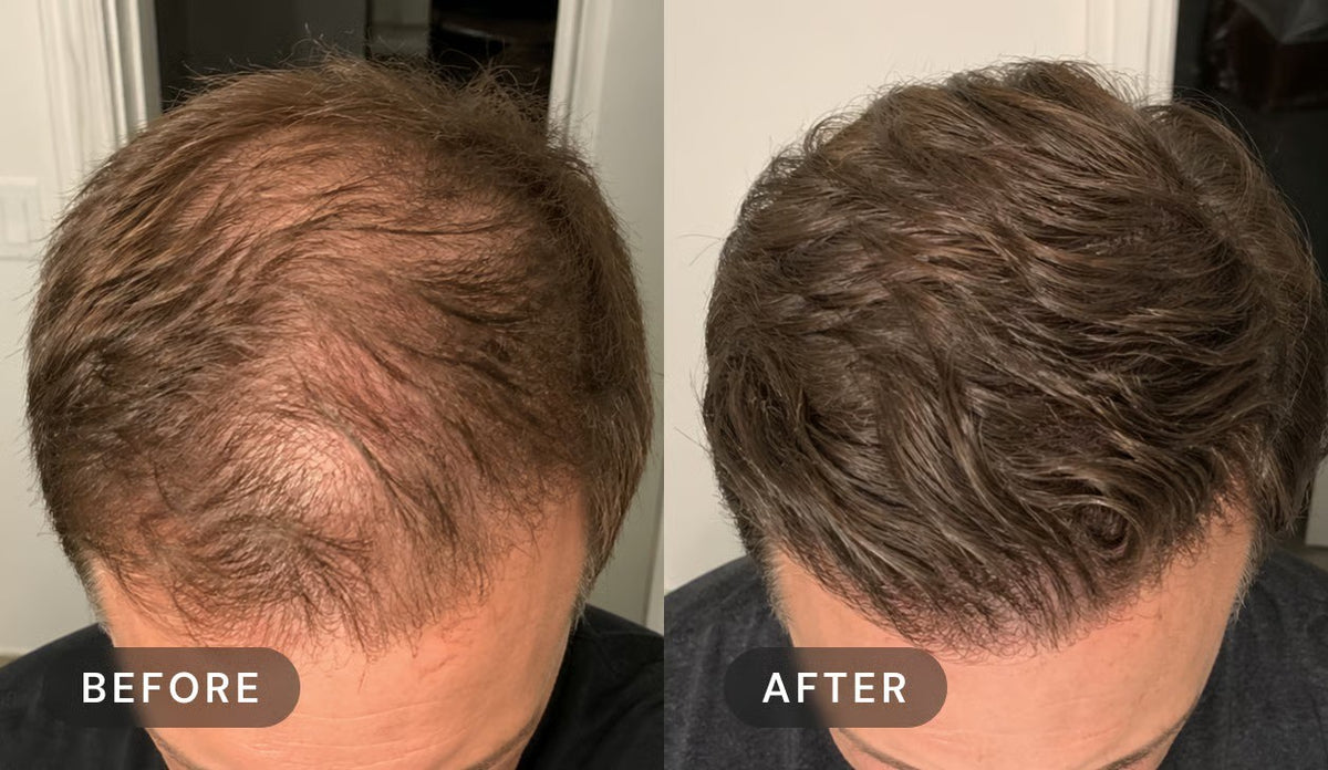 Manufacturer's user trial, before and after: top and front of a man's head with brown hair, seen from above