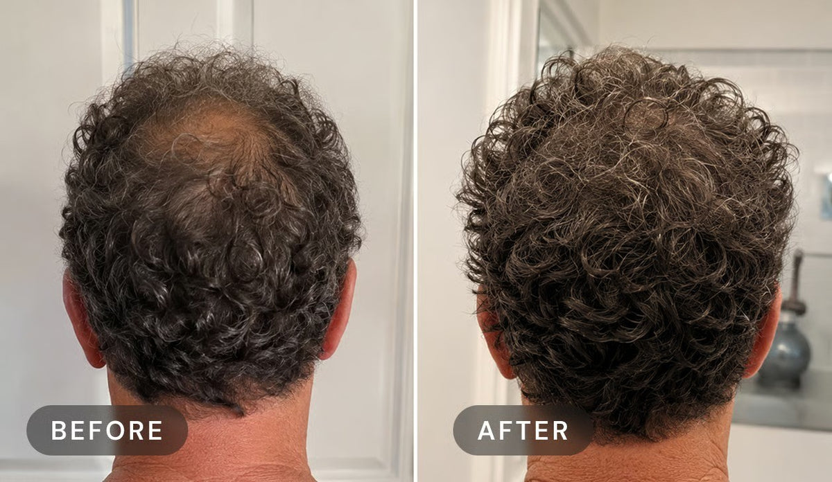 Manufacturer's user trial, before and after: a man's crown with dark curly hair, seen from behind