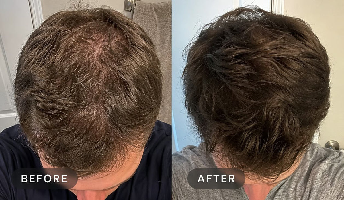 Manufacturer's user trial, before and after: top of a man's head with brown hair, seen from above