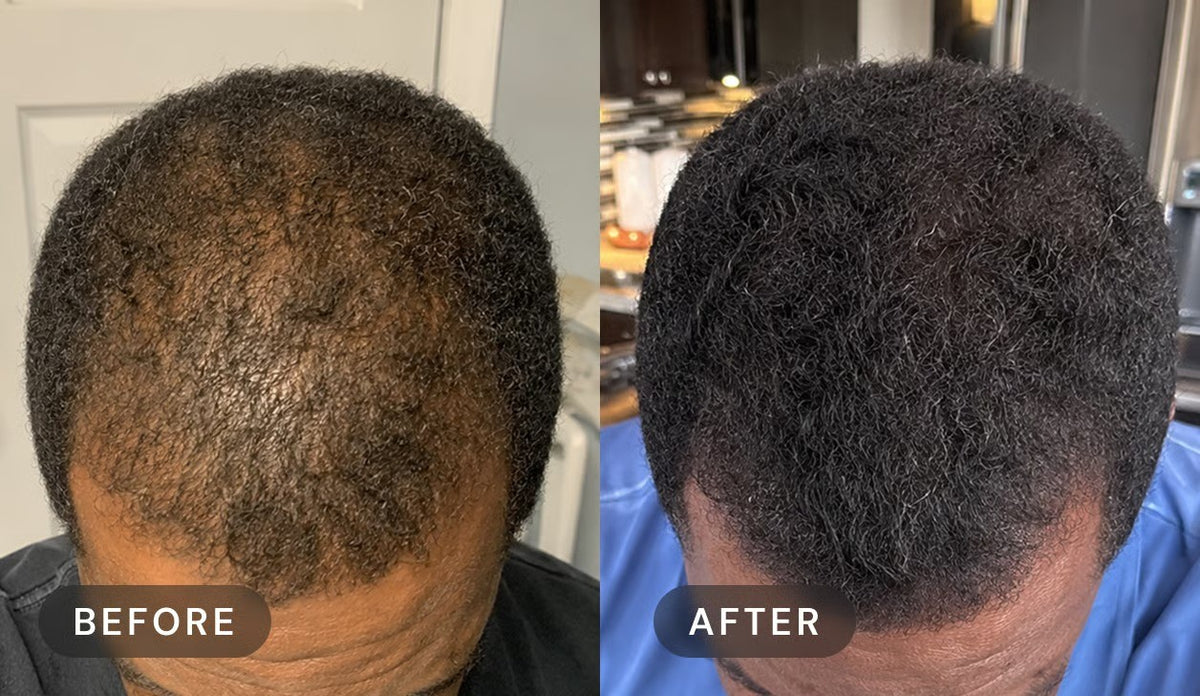 Manufacturer's user trial, before and after: top of a man's head with short black hair, seen from above