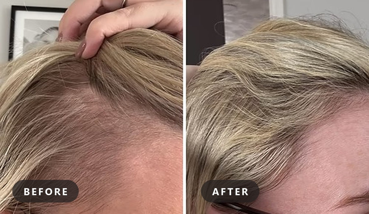 Manufacturer's user trial, before and after: close-up of a woman's hairline and part with blonde hair