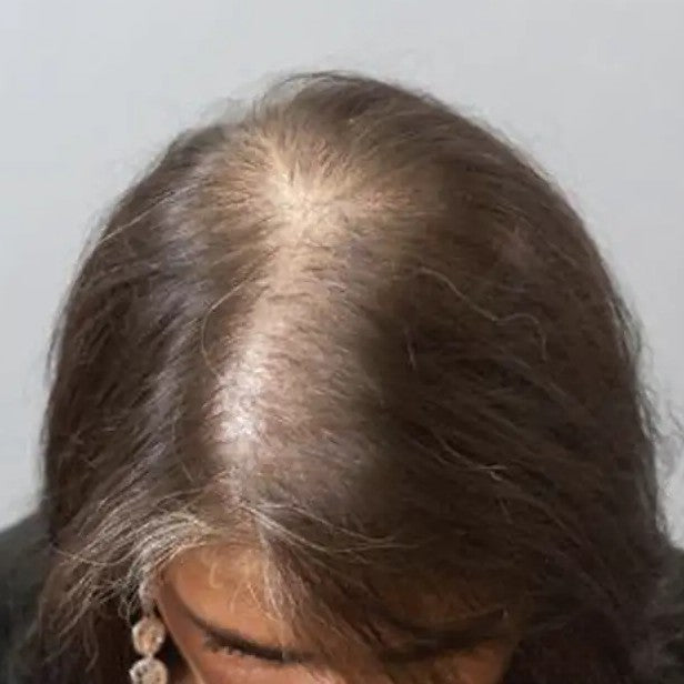 Top view of a wider hair part