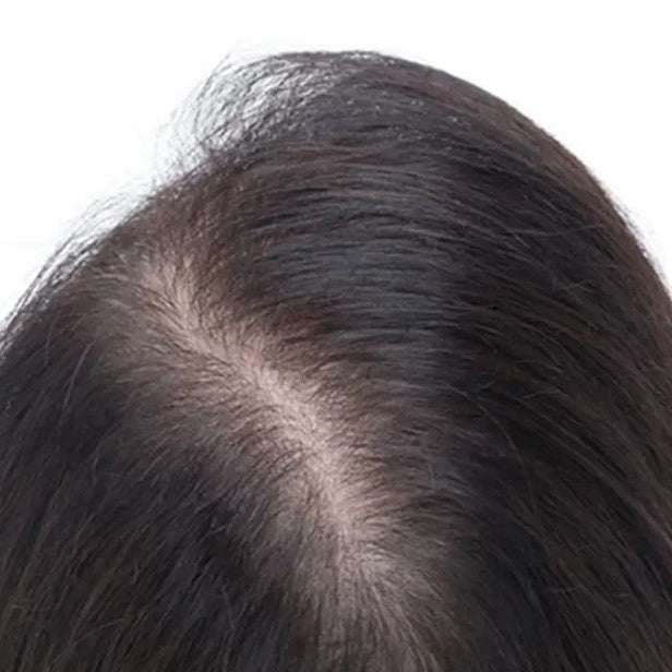 Gradual thinning along the part