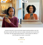 Folliq Red Light Scalp Massager