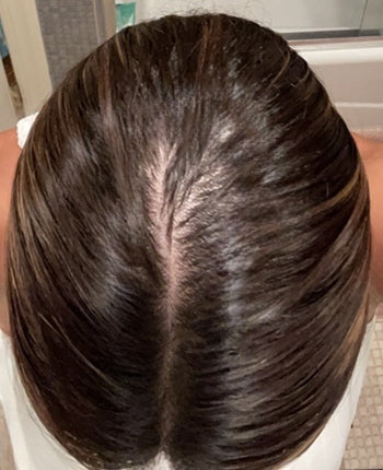 Scalp before starting, week one